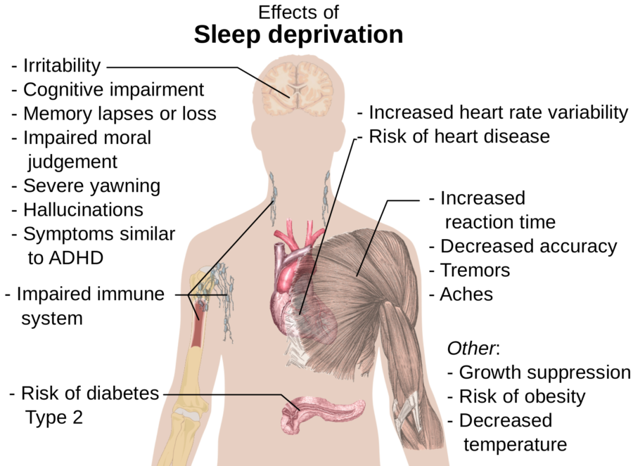 %E2%80%9CThe+most+recent+national+poll+shows+that+more+than+87+percent+of+U.S.+high+school+students+get+far+less+than+the+recommended+eight+to+10+hours+of+sleep+each+night.%E2%80%9D%0AChristopher+Silas+Neal